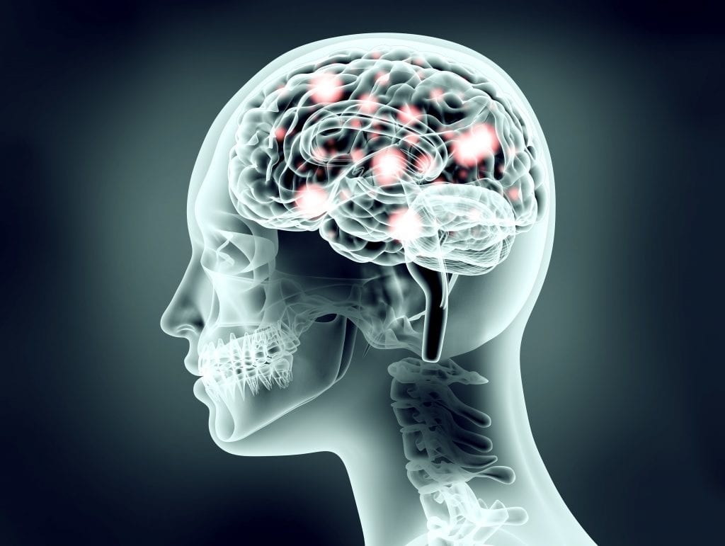 How the court determines if a brain injury victim is eligible for compensation?